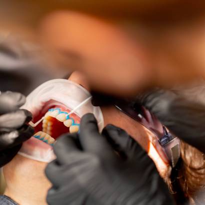 close up dental office girl dentist applies protective gel to the gums of young guy close up dental up office girl dentist applies protective gel to the gums of a young guy